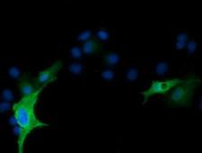 RND1 Antibody - Anti-RND1 mouse monoclonal antibody  immunofluorescent staining of COS7 cells transiently transfected by pCMV6-ENTRY RND1.