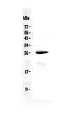 RND1 Antibody - Western blot analysis of RND1 using anti-RND1 antibody. Electrophoresis was performed on a 5-20% SDS-PAGE gel at 70V (Stacking gel) / 90V (Resolving gel) for 2-3 hours. The sample well of each lane was loaded with 50ug of sample under reducing conditions. Lane 1: mouse liver tissue lysate. After Electrophoresis, proteins were transferred to a Nitrocellulose membrane at 150mA for 50-90 minutes. Blocked the membrane with 5% Non-fat Milk/ TBS for 1.5 hour at RT. The membrane was incubated with rabbit anti-RND1 antigen affinity purified polyclonal antibody at 0.5 µg/mL overnight at 4°C, then washed with TBS-0.1% Tween 3 times with 5 minutes each and probed with a goat anti-rabbit IgG-HRP secondary antibody at a dilution of 1:10000 for 1.5 hour at RT. The signal is developed using an Enhanced Chemiluminescent detection (ECL) kit with Tanon 5200 system. A specific band was detected for RND1 at approximately 26KD. The expected band size for RND1 is at 26KD.