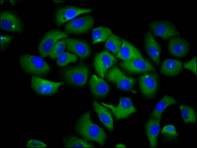 RND1 Antibody - Immunofluorescence staining of A549 cells diluted at 1:66, counter-stained with DAPI. The cells were fixed in 4% formaldehyde, permeabilized using 0.2% Triton X-100 and blocked in 10% normal Goat Serum. The cells were then incubated with the antibody overnight at 4°C.The Secondary antibody was Alexa Fluor 488-congugated AffiniPure Goat Anti-Rabbit IgG (H+L).