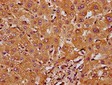 RND1 Antibody - Immunohistochemistry Dilution at 1:200 and staining in paraffin-embedded human liver tissue performed on a Leica BondTM system. After dewaxing and hydration, antigen retrieval was mediated by high pressure in a citrate buffer (pH 6.0). Section was blocked with 10% normal Goat serum 30min at RT. Then primary antibody (1% BSA) was incubated at 4°C overnight. The primary is detected by a biotinylated Secondary antibody and visualized using an HRP conjugated SP system.