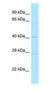 RND2 Antibody - RND2 antibody Western Blot of MCF7.  This image was taken for the unconjugated form of this product. Other forms have not been tested.