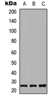 RND2 Antibody - Western blot analysis of RND2 expression in HEK293T (A); NS-1 (B); PC12 (C) whole cell lysates.