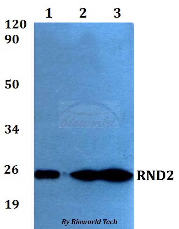 RND2 Antibody - Western blot of RND2 antibody at 1:500 dilution. Lane 1: HEK293T whole cell lysate. Lane 2: sp2/0 whole cell lysate. Lane 3: PC12 whole cell lysate.