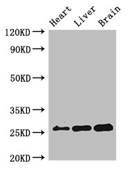 RND2 Antibody - Positive WB detected in:Mouse heart tissue,Mouse liver tissue,Mouse brain tissue;All lanes:RND2 antibody at 2?g/ml;Secondary;Goat polyclonal to rabbit IgG at 1/50000 dilution;Predicted band size: 26 KDa;Observed band size: 26 KDa;