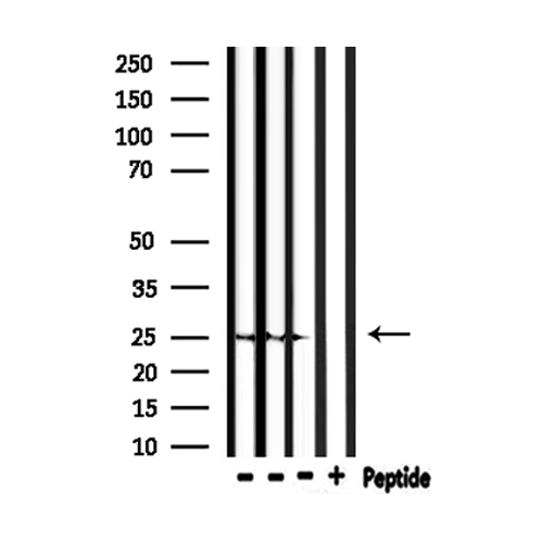 RND2 Antibody - Western blot analysis of extracts of mouse brain, mouse liver, rat brain tissue using RND2 antibody.