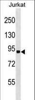 RNF10 Antibody - RNF10 Antibody western blot of Jurkat cell line lysates (35 ug/lane). The RNF10 antibody detected the RNF10 protein (arrow).