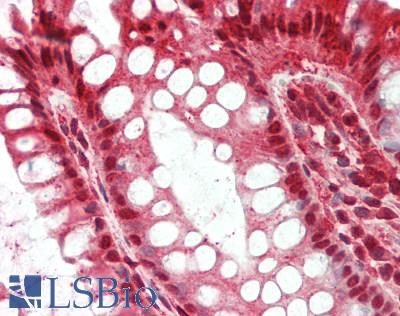 RNF10 Antibody - Human Colon: Formalin-Fixed, Paraffin-Embedded (FFPE).  This image was taken for the unconjugated form of this product. Other forms have not been tested.