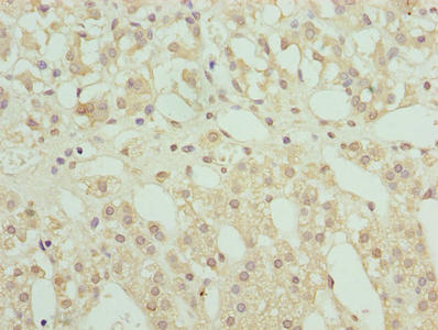 RNF10 Antibody - Immunohistochemistry of paraffin-embedded human adrenal gland tissue using RNF10 Antibody at dilution of 1:100