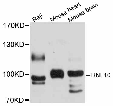 RNF10 Antibody - Western blot analysis of extracts of various cell lines, using RNF10 antibody at 1:1000 dilution. The secondary antibody used was an HRP Goat Anti-Rabbit IgG (H+L) at 1:10000 dilution. Lysates were loaded 25ug per lane and 3% nonfat dry milk in TBST was used for blocking. An ECL Kit was used for detection and the exposure time was 1s.
