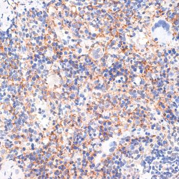 RNF10 Antibody - Immunohistochemistry of paraffin-embedded Rat spleen using RNF10 Polyclonal Antibody at dilution of 1:100 (40x lens).