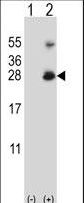 RNF11 Antibody - Western blot of RNF11 (arrow) using rabbit polyclonal RNF11 Antibody. 293 cell lysates (2 ug/lane) either nontransfected (Lane 1) or transiently transfected (Lane 2) with the RNF11 gene.