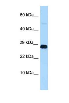 RNF11 Antibody - Western blot of Rat Lung lysate. Anti-RNF11 Antibody concentration 1 ug/ml.  This image was taken for the unconjugated form of this product. Other forms have not been tested.