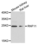 RNF11 Antibody - Western blot analysis of extract of various cells.