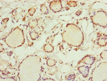 RNF11 Antibody - Immunohistochemistry of paraffin-embedded human thyroid tissue at dilution of 1:100