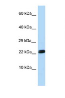 RNF11 Antibody - RNF11 antibody Western blot of Rat Liver lysate. Antibody concentration 1 ug/ml.  This image was taken for the unconjugated form of this product. Other forms have not been tested.