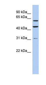 RNF112 / ZNF179 Antibody - RNF112 / ZNF179 antibody Western blot of OVCAR-3 cell lysate. This image was taken for the unconjugated form of this product. Other forms have not been tested.