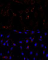 RNF112 / ZNF179 Antibody - Immunofluorescence analysis of C6 cells using RNF112 Polyclonal Antibody at dilution of 1:100.Blue: DAPI for nuclear staining.