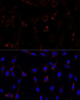 RNF112 / ZNF179 Antibody - Immunofluorescence analysis of C6 cells using RNF112 Polyclonal Antibody at dilution of 1:100.Blue: DAPI for nuclear staining.