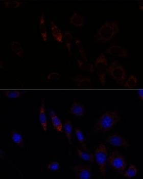 RNF112 / ZNF179 Antibody - Immunofluorescence analysis of L929 cells using RNF112 Polyclonal Antibody at dilution of 1:100.Blue: DAPI for nuclear staining.