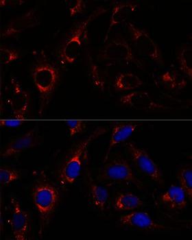 RNF112 / ZNF179 Antibody - Immunofluorescence analysis of U-2OS cells using RNF112 Polyclonal Antibody at dilution of 1:100.Blue: DAPI for nuclear staining.