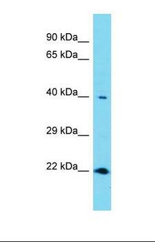 RNF113A Antibody - Western blot of Human Thyroid Tumor. RNF113A antibody dilution 1.0 ug/ml.  This image was taken for the unconjugated form of this product. Other forms have not been tested.