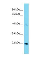 RNF113A Antibody - Western blot of Human Thyroid Tumor. RNF113A antibody dilution 1.0 ug/ml.  This image was taken for the unconjugated form of this product. Other forms have not been tested.