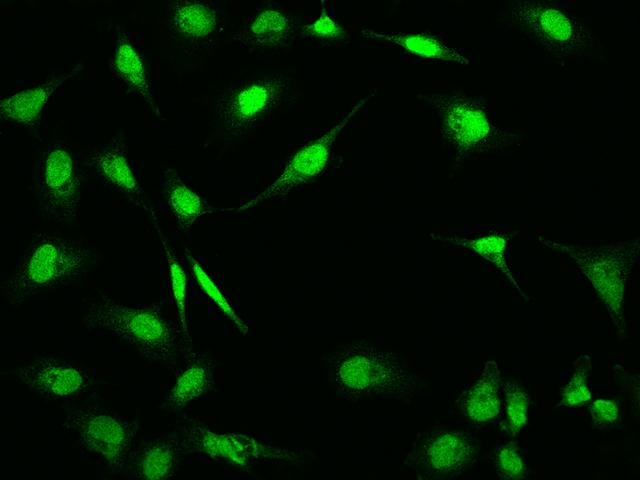 RNF113A Antibody - Immunofluorescence staining of RNF113A in Hela cells. Cells were fixed with 4% PFA, permeabilzed with 0.1% Triton X-100 in PBS, blocked with 10% serum, and incubated with rabbit anti-Human RNF113A polyclonal antibody (dilution ratio 1:200) at 4°C overnight. Then cells were stained with the Alexa Fluor 488-conjugated Goat Anti-rabbit IgG secondary antibody (green). Positive staining was localized to Nucleus.