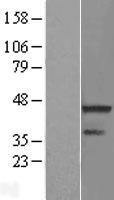 RNF113A Protein - Western validation with an anti-DDK antibody * L: Control HEK293 lysate R: Over-expression lysate