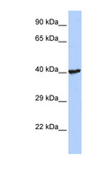 RNF113B Antibody - RNF113B antibody Western blot of Jurkat lysate. This image was taken for the unconjugated form of this product. Other forms have not been tested.