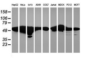 RNF113B Antibody - Western blot of extracts (35ug) from 9 different cell lines by using anti-RNF113B monoclonal antibody.