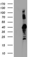 RNF113B Antibody - HEK293T cells were transfected with the pCMV6-ENTRY control (Left lane) or pCMV6-ENTRY RNF113B (Right lane) cDNA for 48 hrs and lysed. Equivalent amounts of cell lysates (5 ug per lane) were separated by SDS-PAGE and immunoblotted with anti-RNF113B.