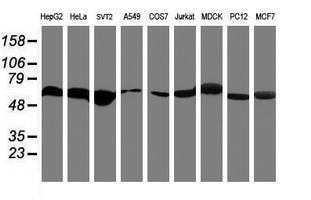 RNF113B Antibody - Western blot of extracts (35 ug) from 9 different cell lines by using anti-RNF113B monoclonal antibody.