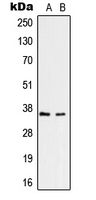 RNF113B Antibody - Western blot analysis of RNF113B expression in HepG2 (A); Jurkat (B) whole cell lysates.