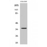 RNF113B Antibody - Western blot of RNF113B antibody