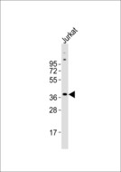 RNF113B Antibody - Anti-RNF113B Antibody at 1:1000 dilution + Jurkat whole cell lysates Lysates/proteins at 20 ug per lane. Secondary Goat Anti-Rabbit IgG, (H+L),Peroxidase conjugated at 1/10000 dilution Predicted band size : 36 kDa Blocking/Dilution buffer: 5% NFDM/TBST.