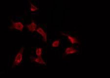 RNF113B Antibody - Staining HepG2 cells by IF/ICC. The samples were fixed with PFA and permeabilized in 0.1% Triton X-100, then blocked in 10% serum for 45 min at 25°C. The primary antibody was diluted at 1:200 and incubated with the sample for 1 hour at 37°C. An Alexa Fluor 594 conjugated goat anti-rabbit IgG (H+L) Ab, diluted at 1/600, was used as the secondary antibody.