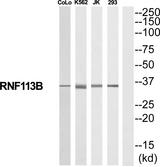 RNF113B Antibody - Western blot analysis of extracts from COLO205/K562/Jurkat/293 cells, using RNF113B antibody.