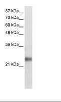 RNF114 / ZNF313 Antibody - Transfected 293T Cell Lysate.  This image was taken for the unconjugated form of this product. Other forms have not been tested.