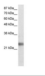RNF114 / ZNF313 Antibody - Transfected 293T Cell Lysate.  This image was taken for the unconjugated form of this product. Other forms have not been tested.