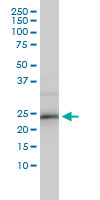 RNF114 / ZNF313 Antibody - ZNF313 monoclonal antibody (M01), clone 4G3-1A10 Western blot of ZNF313 expression in HepG2.