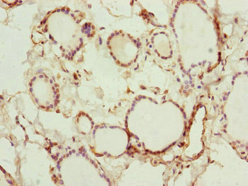 RNF114 / ZNF313 Antibody - Immunohistochemistry of paraffin-embedded human thyroid tissue at dilution of 1:100