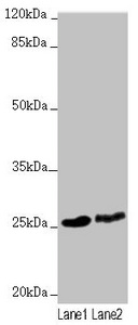 RNF114 / ZNF313 Antibody - Western blot All Lanes:RNF114 antibody at 1.63 ug/ml Lane 1: 293T whole cell lysate Lane 2: HepG-2 whole cell lysate Secondary Goat polyclonal to rabbit IgG at 1/10000 dilution Predicted band size: 26,22 kDa Observed band size: 26 kDa