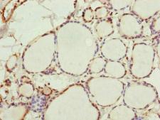 RNF114 / ZNF313 Antibody - Immunohistochemistry of paraffin-embedded human thyroid tissue at dilution of 1:100