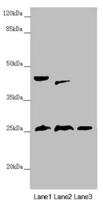 RNF114 / ZNF313 Antibody - Western blot All Lanes:RNF114 antibody at 0.87 ug/ml Lane 1: Rat heart tissue Lane 2: Mouse gonadal tissue Lane 3: HepG-2 whole cell lysate Secondary Goat polyclonal to rabbit IgG at 1/10000 dilution Predicted band size: 26,22 kDa Observed band size: 26,40,45 kDa