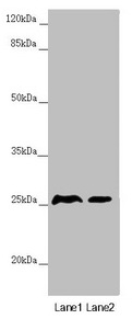 RNF114 / ZNF313 Antibody - Western blot All lanes: RNF114 antibody at 0.87µg/ml Lane 1: Mouse gonadal tissue Lane 2: 293T whole cell lysate Secondary Goat polyclonal to rabbit IgG at 1/10000 dilution Predicted band size: 26, 22 kDa Observed band size: 26 kDa