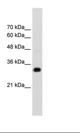 RNF121 Antibody - Jurkat Cell Lysate.  This image was taken for the unconjugated form of this product. Other forms have not been tested.
