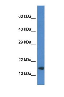 RNF122 Antibody - RNF122 antibody Western blot of Mouse Heart lysate. Antibody concentration 1 ug/ml. This image was taken for the unconjugated form of this product. Other forms have not been tested.