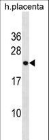 RNF122 Antibody - RNF122 Antibody western blot of human placenta tissue lysates (35 ug/lane). The RNF122 antibody detected the RNF122 protein (arrow).