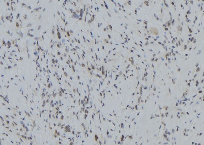 RNF123 Antibody - 1:100 staining human gastric tissue by IHC-P. The sample was formaldehyde fixed and a heat mediated antigen retrieval step in citrate buffer was performed. The sample was then blocked and incubated with the antibody for 1.5 hours at 22°C. An HRP conjugated goat anti-rabbit antibody was used as the secondary.