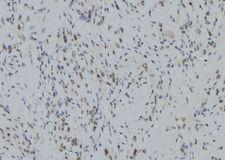 RNF123 Antibody - 1:100 staining human gastric tissue by IHC-P. The sample was formaldehyde fixed and a heat mediated antigen retrieval step in citrate buffer was performed. The sample was then blocked and incubated with the antibody for 1.5 hours at 22°C. An HRP conjugated goat anti-rabbit antibody was used as the secondary.